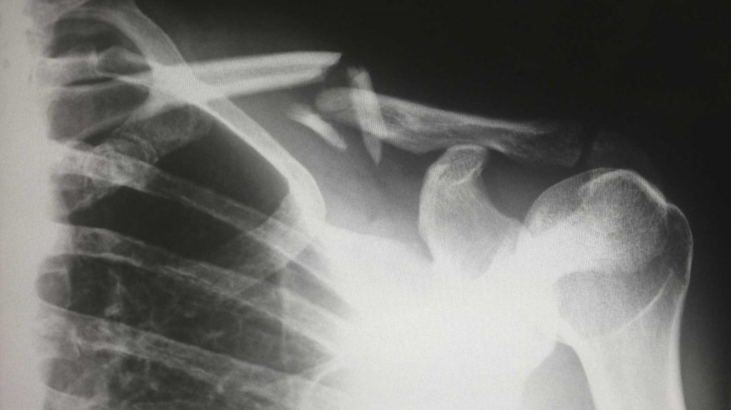 Types-of-Medical-Imaging-Data-Storage-Types-Do-Did-You-Prefer-on-americastrend