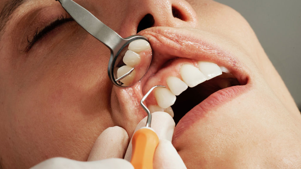 Things-You-Must-Avoid-Getting-Decayed-Teeth-on-americastrend