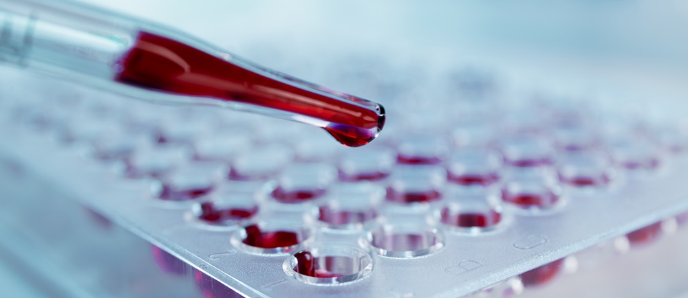 laboratory for blood work